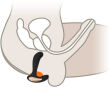 MASAŻER PROSTATY STEROWANY PILOTEM - 12 FUNKCJI - WIBRATOR ANALNY - 71773424 - 3